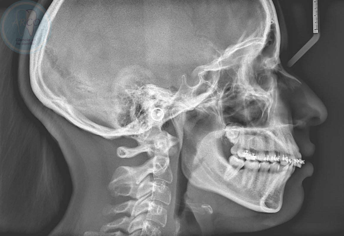Radiografia Lateral