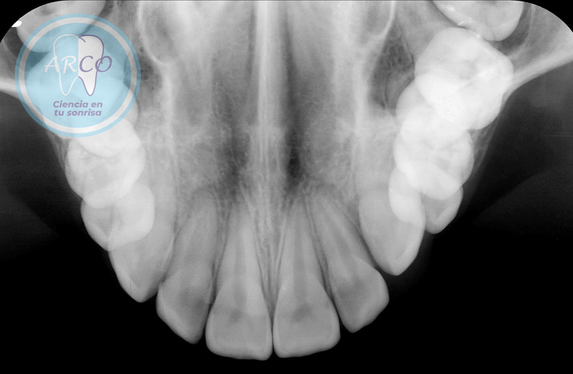 Radiografia Lateral