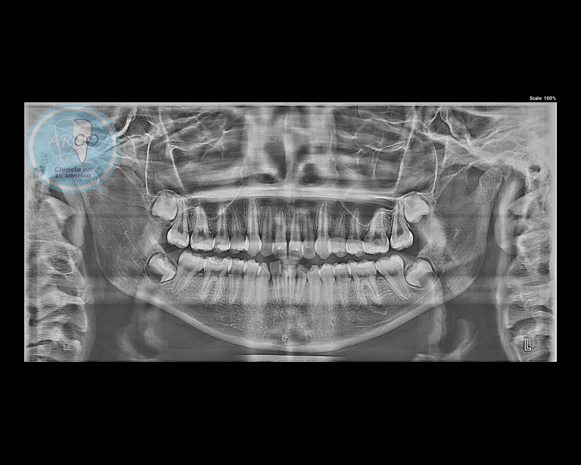 Radiografia Lateral