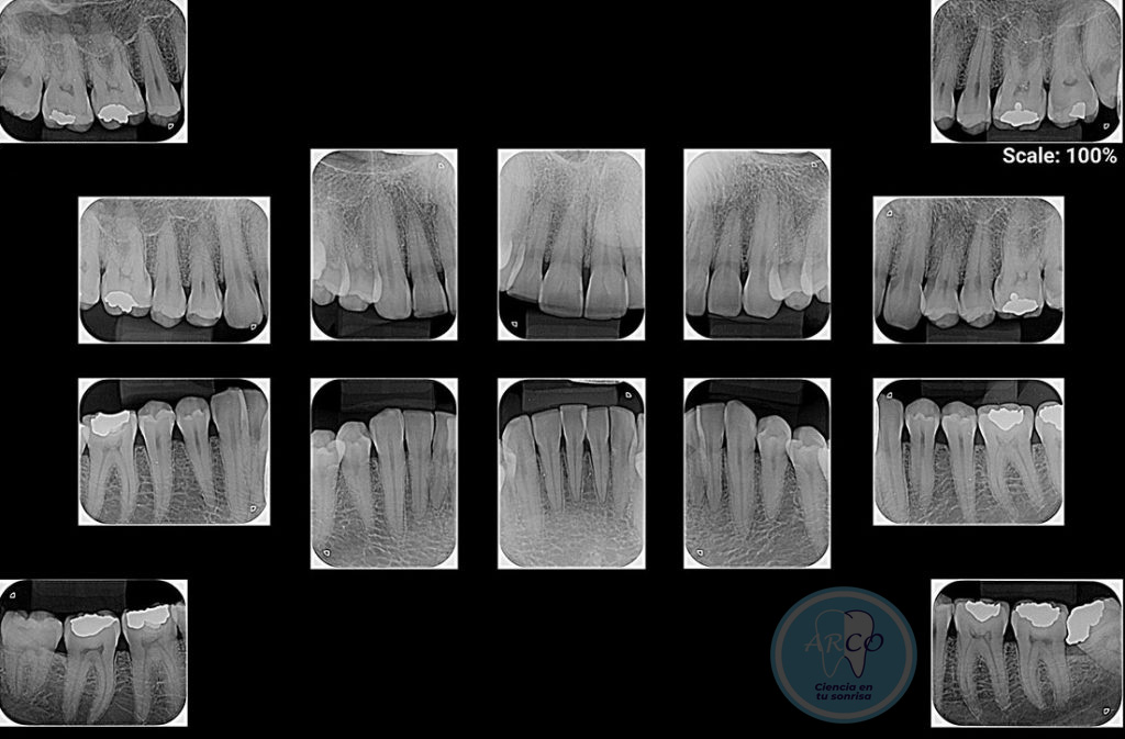 Radiografia Lateral